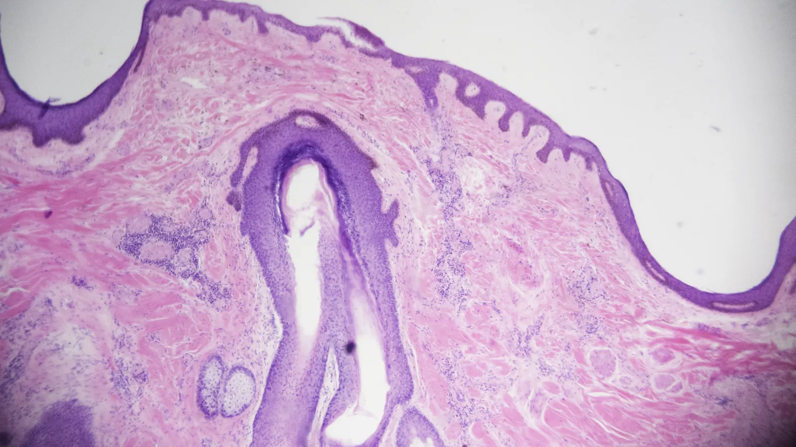 Corte histológico de couro cabeludo visto ao microscópio, com a epiderme, um folículo piloso e glândulas sebáceas corados em roxo e rosa.